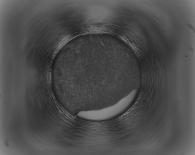 X0000097471459200803201437