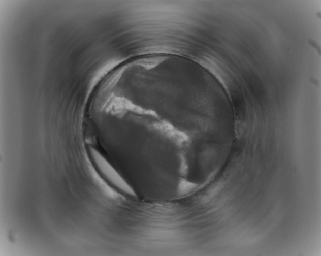 X0000097480995200803141931