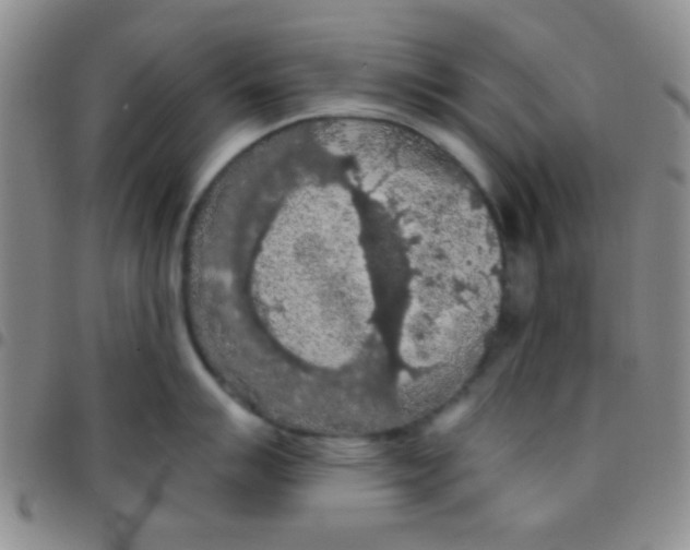 X0000097481007200803141930