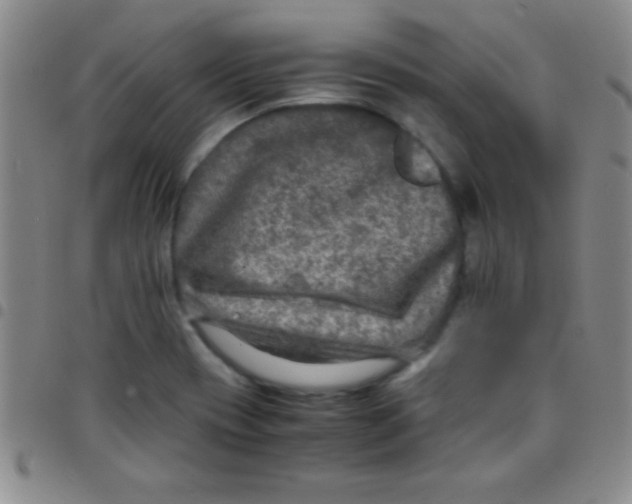 X0000097481417200803141925