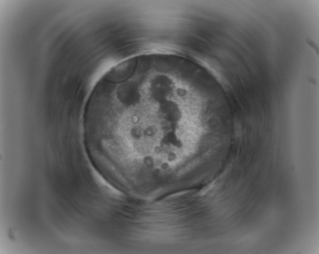 X0000097481471200803141924