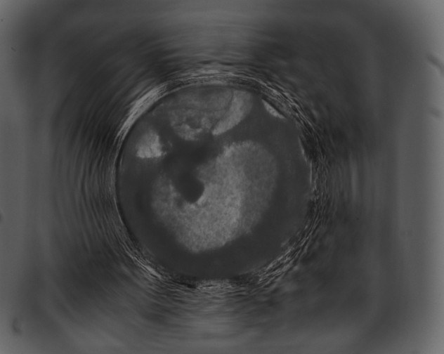 X0000097480099200803201518