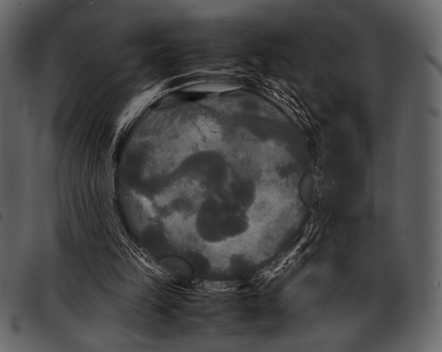 X0000097480149200803201516