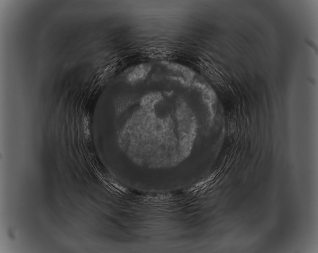 X0000097481106200803201503