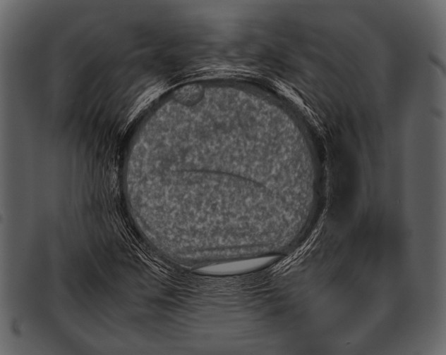 X0000097481259200803201502