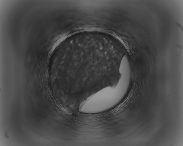 X0000097481263200803201502