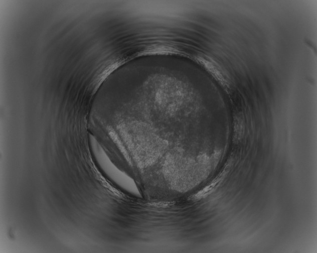 X0000097481329200803201501