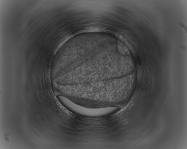 X0000097481417200803201500