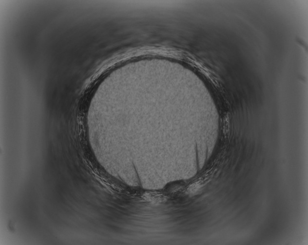 X0000097481496200803201458