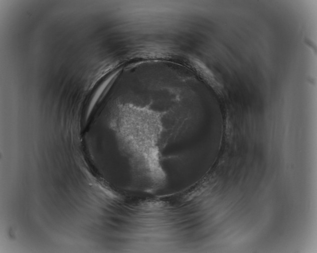 X0000097490202200803071747