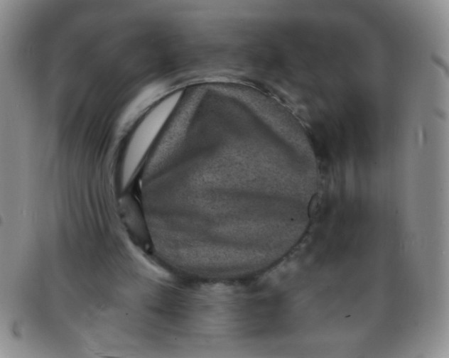 X0000097490197200803142005