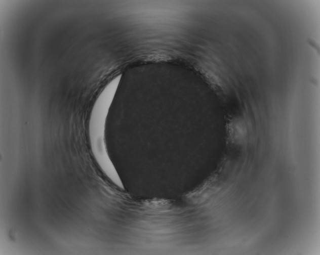 X0000097500517200803071805