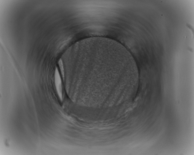 X0000097500017200803142029