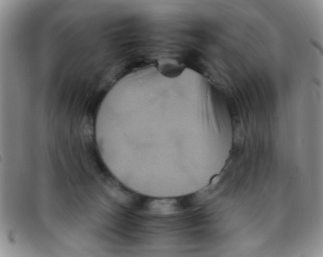 X0000097500179200803142027