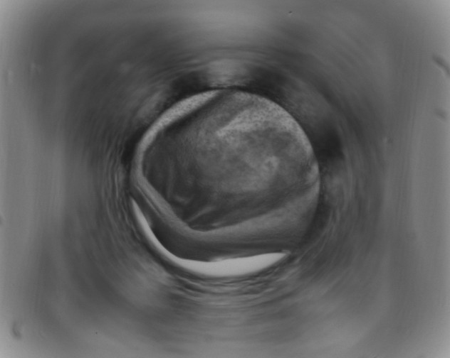 X0000097500219200803142026