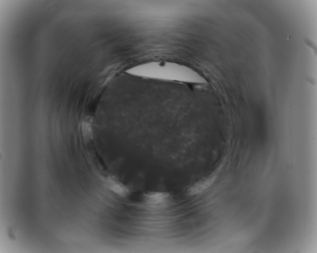 X0000097500432200803142023