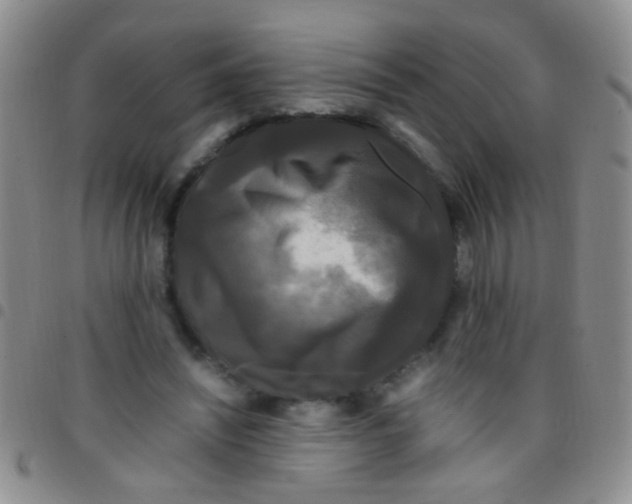 X0000097500444200803142023