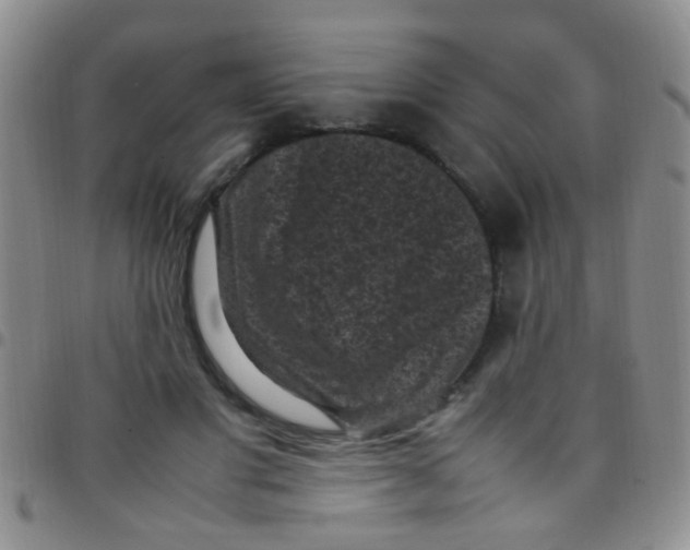 X0000097500501200803142022