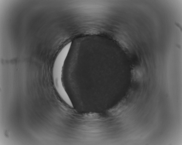 X0000097500517200803142022