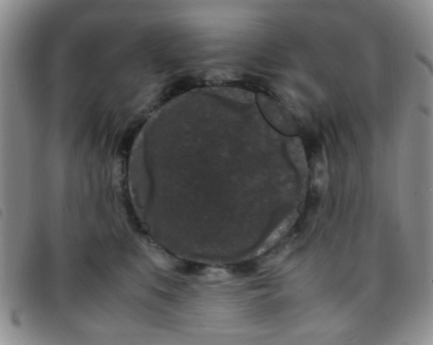 X0000097500519200803142022