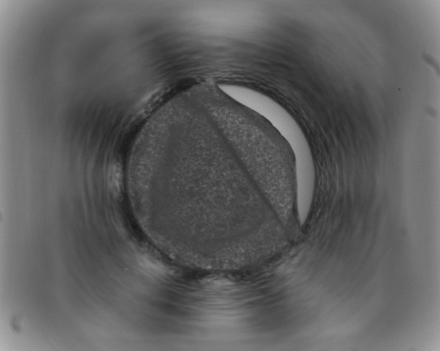 X0000097500648200803142020