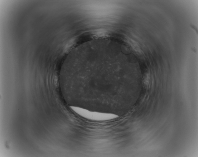 X0000097500715200803142019