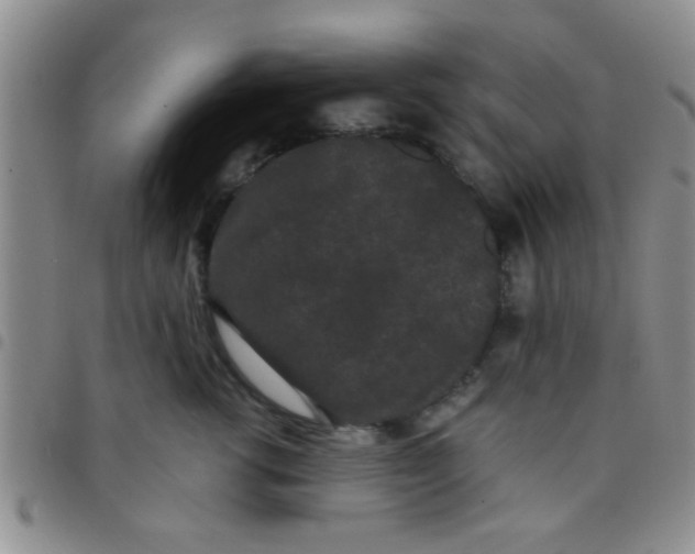 X0000097500762200803142019