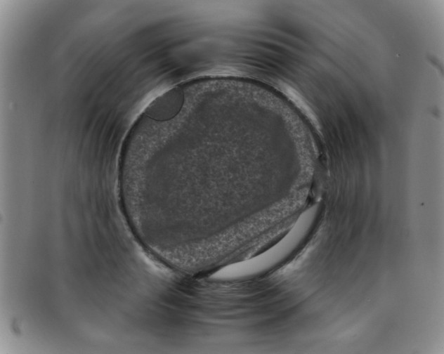 X0000097500845200803142018