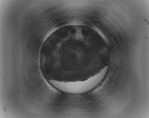 X0000097500853200803142018