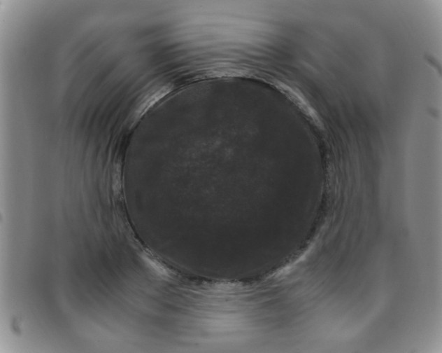 X0000097500889200803142017