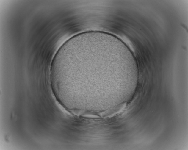 X0000097500903200803142017