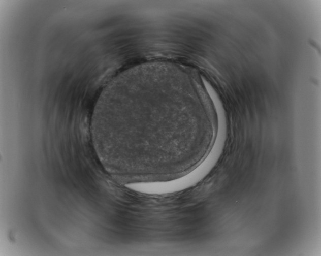 X0000097500915200803142016