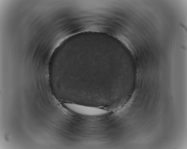 X0000097500923200803142016