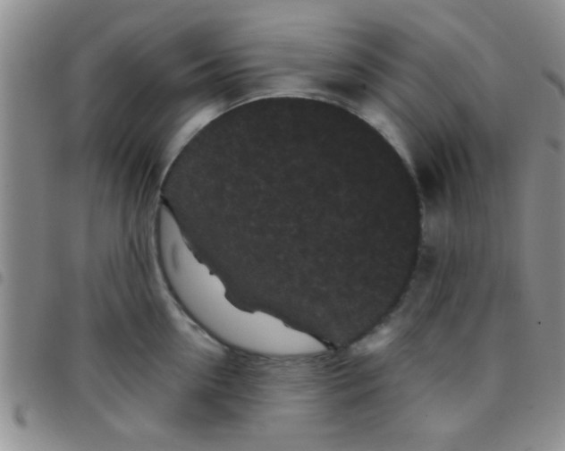 X0000097500954200803142016