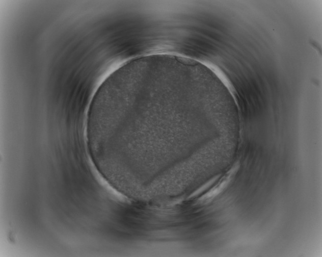 X0000097500957200803142016