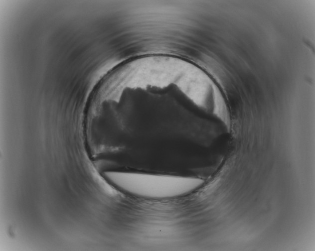 X0000097500995200803142015