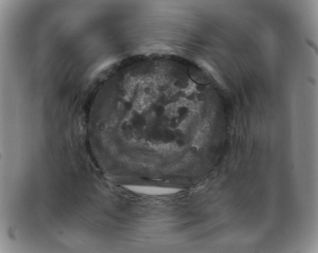 X0000097501063200803142014