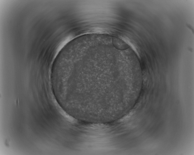 X0000097501091200803142014