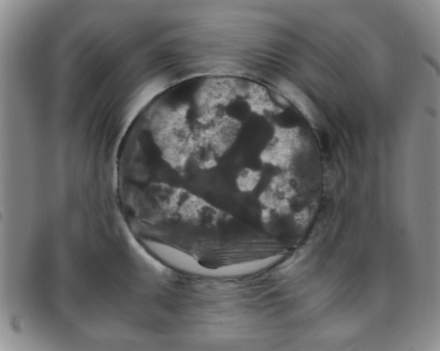 X0000097501095200803142014