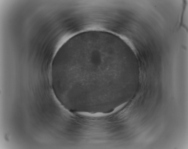 X0000097501295200803142011