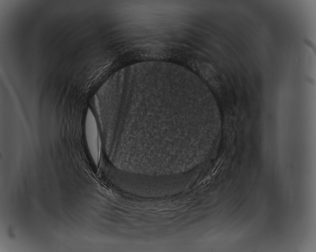 X0000097500017200803201602