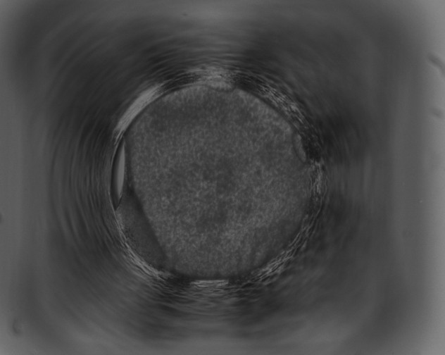 X0000097500051200803201601