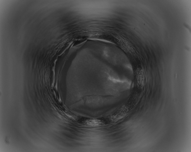 X0000097500316200803201558