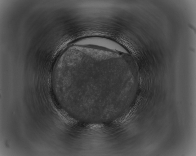 X0000097500352200803201557