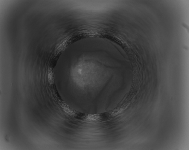 X0000097500720200803201552