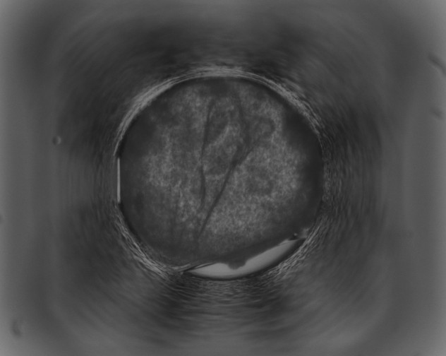 X0000097501223200803201545