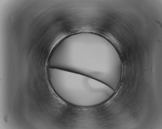 X0000097511190200802220858