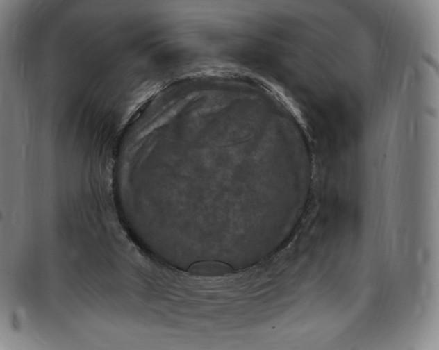 X0000097510010200803071835