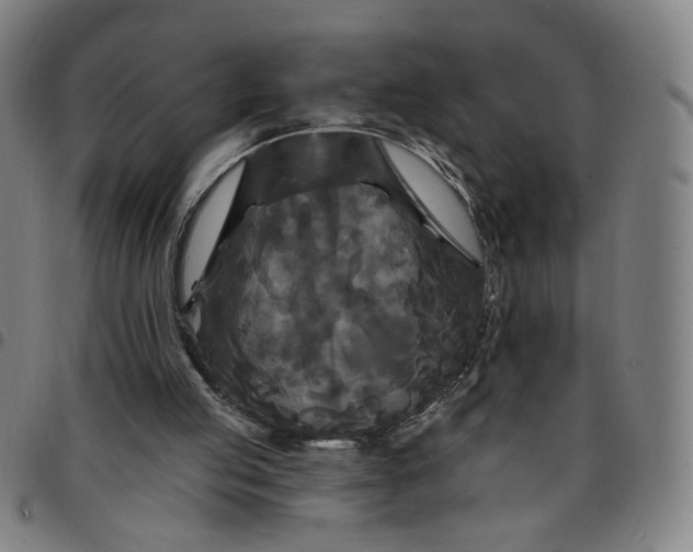 X0000097510053200803071834