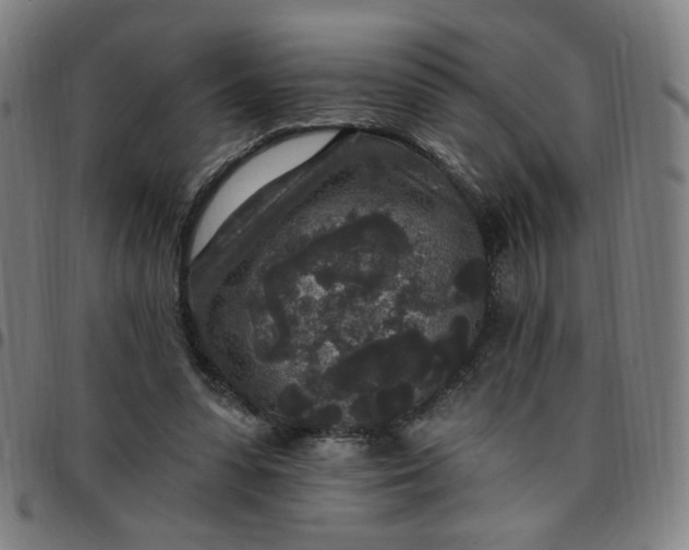 X0000097510303200803071830